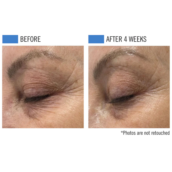 Ultra-Adaptive 5-in-1 Concentrate